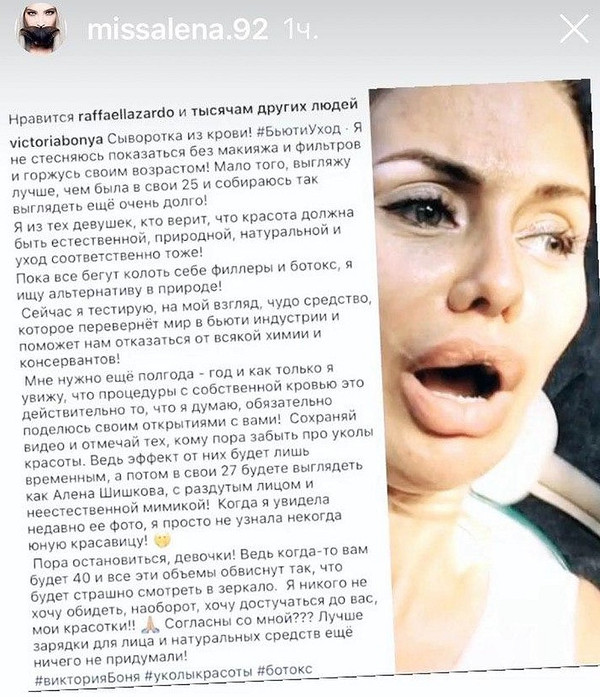 Алена Шишкова ответила раскритиковавшей ее внешность Виктории Боне