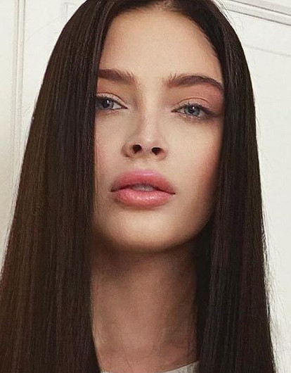 Алена Шишкова показала, как ей колют ботокс в лоб (видео)