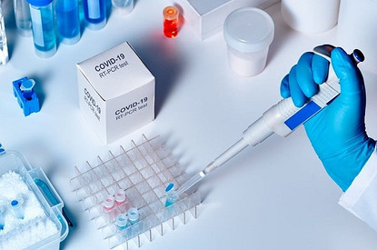 В России создали тест для выявления коронавируса у животных