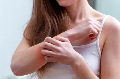 Дерматит: виноват ли в нем иммунитет или психологические причины