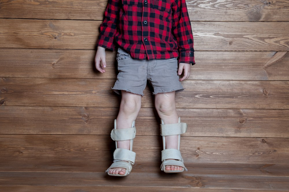 Ортопедическая обувь для детей: как выбрать, и нужна ли она ребенку (советует специалист)