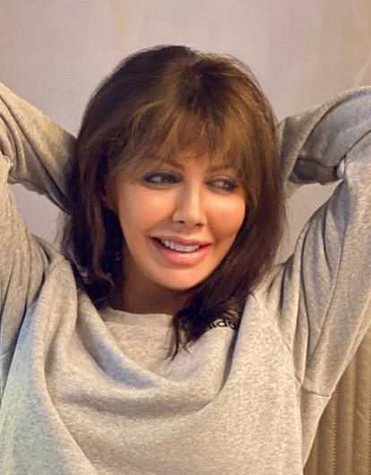 Экс-супруга Аршавина Алиса Казьмина перестала скрывать пораженное болезнью лицо