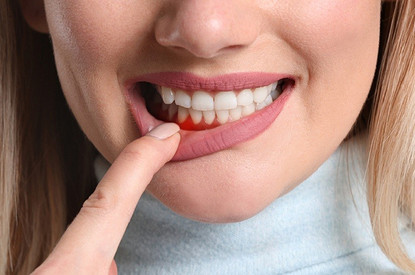 Что такое рецессия десен и 8 проблем с ротовой полостью, к которым она приводит