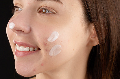 Дешево и сердито: спасет ли цинковая мазь от прыщей