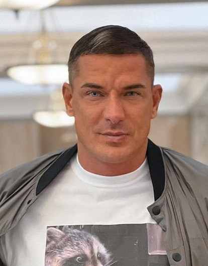 Экс-супруг Ксении Бородиной показал, как сделал операцию по пересадке волос в бороду