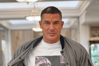 Экс-супруг Ксении Бородиной показал, как сделал операцию по пересадке волос в бороду