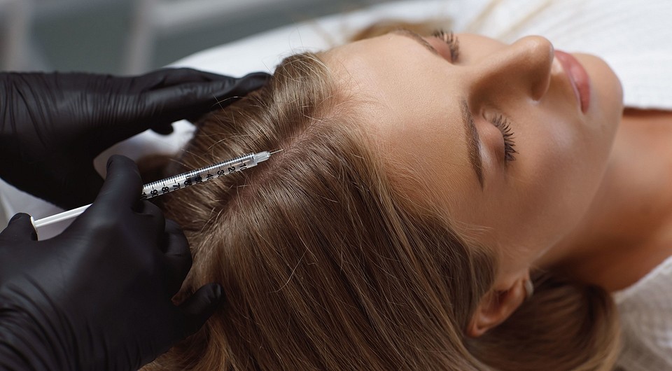 Мезотерапия для волос: все, что ты хотела знать об этой процедуре