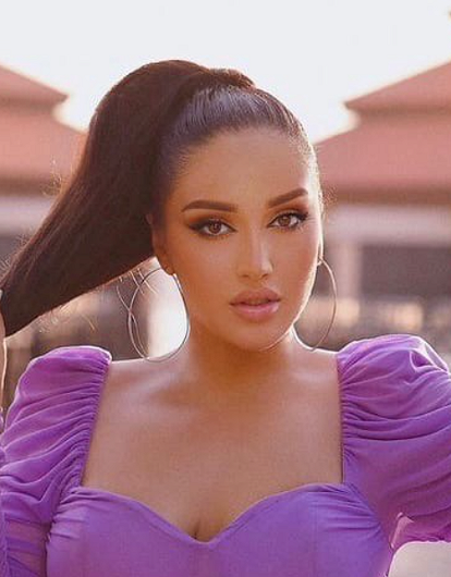 Гоар Аветисян показала фигуру после пластики тела