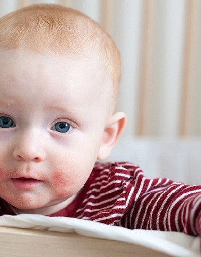 Психологические причины атопического дерматита у детей