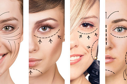 Энциклопедия красоты. Филлеры: что это такое — рассказывает косметолог