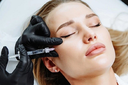 Коррекция скул филлерами: как изменить внешность за 15 минут (мнение косметолога)