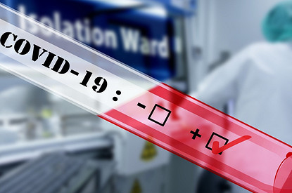 Антитела к Covid-19: 9 ответов на вопросы, которые важно знать