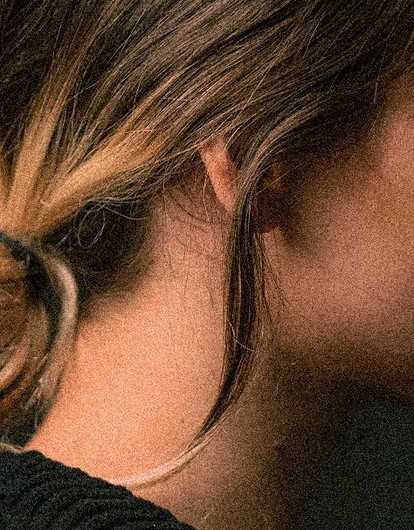 Плазмолифтинг от выпадения волос: как это работает (и работает ли вообще)