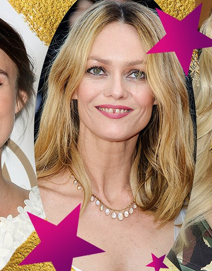 Мадонна, Кира Найтли и другие звезды, которые не могут похвастаться идеальными улыбками