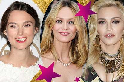 Мадонна, Кира Найтли и другие звезды, которые не могут похвастаться идеальными улыбками