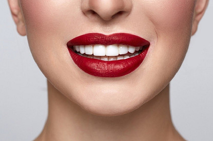 Привет, Голливуд: стоит ли ставить виниры на здоровые зубы