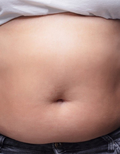 Неспасательный круг: как убрать висцеральный жир и чем он может быть опасен