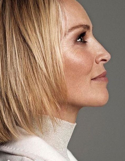 Типы старения лица на примерах звезд: от мелкоморщинистого у Шэрон Стоун до деформационного у Яны Рудковской