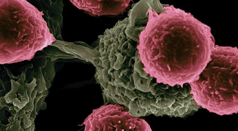 Все о тромбозе вен ног и тромбоэмболии легочной артерии: почему появляется и как коронавирус влияет на ее развитие