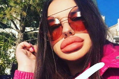 Пора «откачивать» обратно: 4 устаревших тренда в пластической хирургии