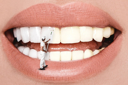 От безупречного идеала до естественности: как изменились стоматологические тренды