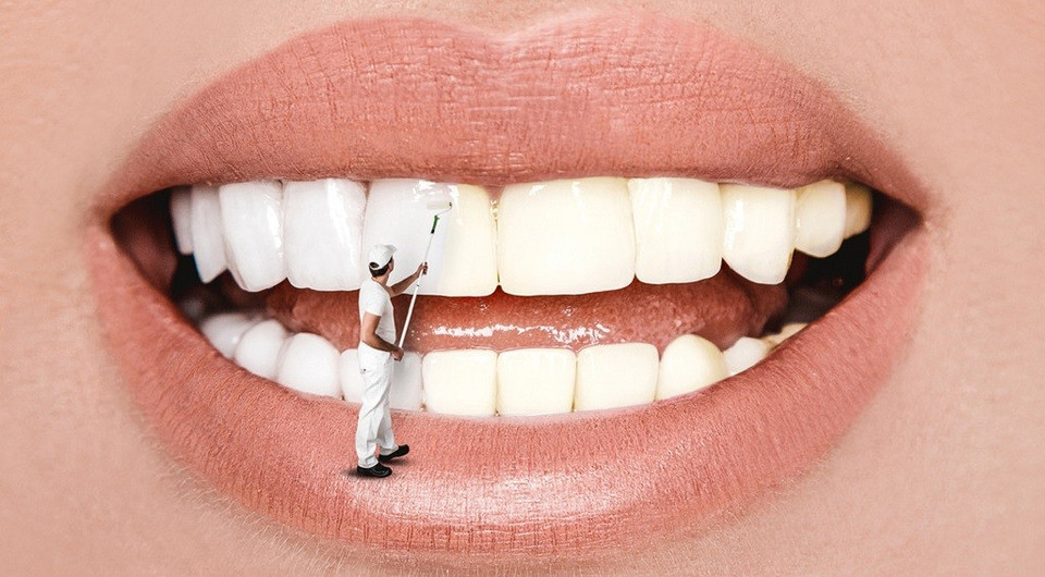От безупречного идеала до естественности: как изменились стоматологические тренды