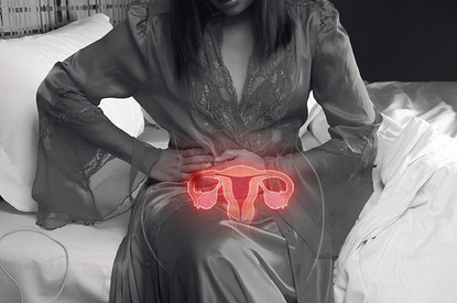 Миома матки: современный способ вылечить ее безопасно