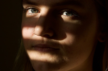 С этим носом явно что-то не так: 5 поводов для повторной ринопластики