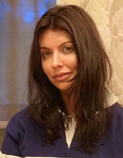 «Становится все хуже»: тяжелобольная Алиса Казьмина призналась, что у нее не хватает денег на важную операцию