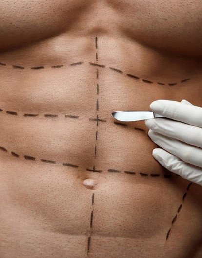 Они тоже делают это: 5 самых популярных у мужчин пластических операций