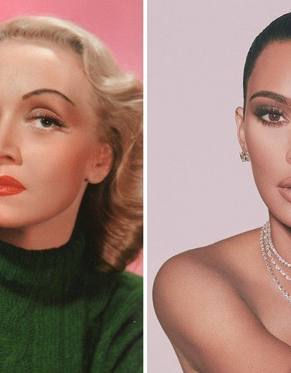 От Дитрих до Кардашьян: звезды, которые удалили зубы мудрости ради выразительных скул