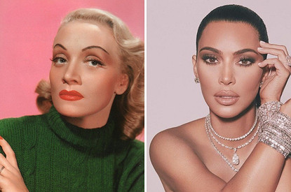 От Дитрих до Кардашьян: звезды, которые удалили зубы мудрости ради выразительных скул