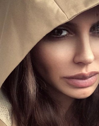 Какие бьюти-процедуры нельзя делать пациентам с аутоиммунными заболеваниями: кейс Алисы Аршавиной