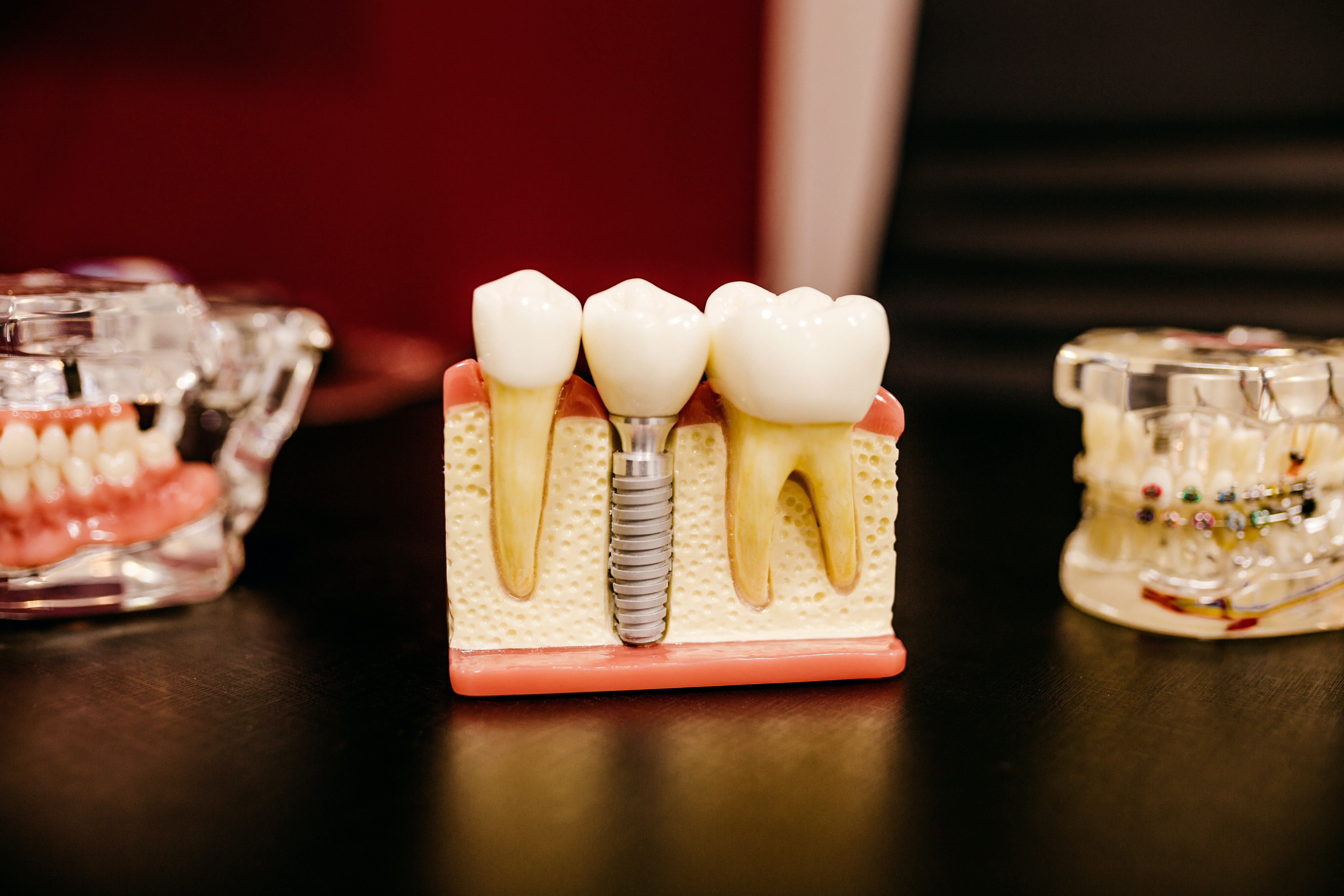 Зубные травмы у детей: какие бывают и к каким последствиям могут привести, если их вовремя не вылечить