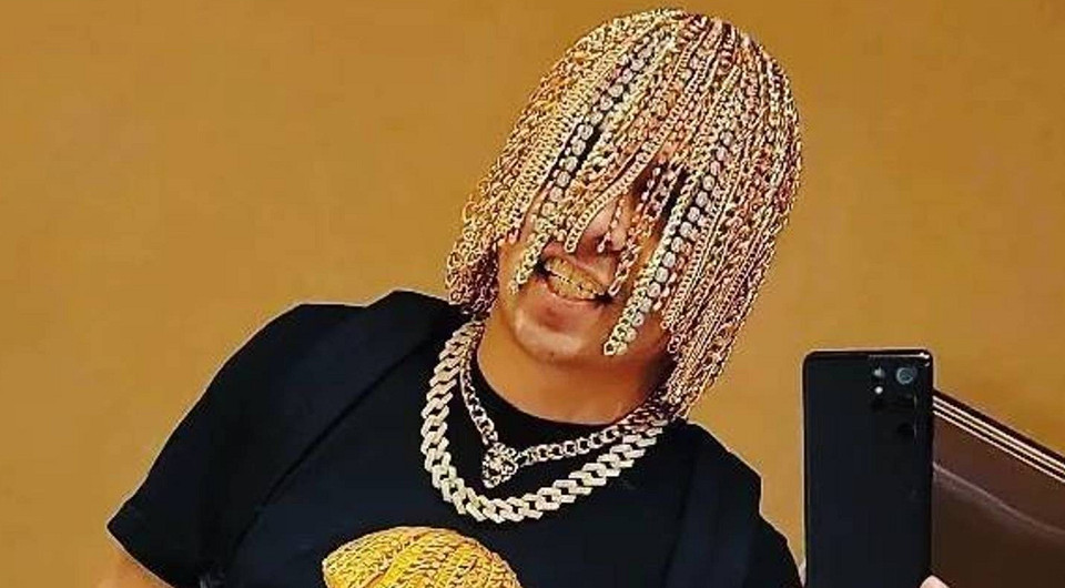 Мексиканский рэпер вживил золотые цепи в голову вместо волос