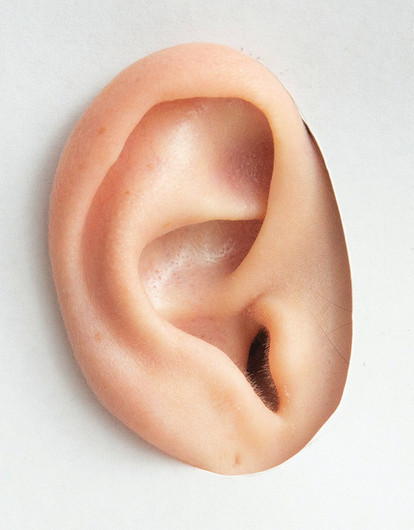 Теперь не Чебурашка: 5 фактов, которые нужно знать, если ты решилась на отопластику