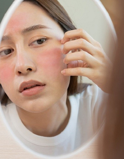 Нездоровый румянец: как вылечить красные пятна на коже