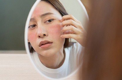 Нездоровый румянец: как вылечить красные пятна на коже