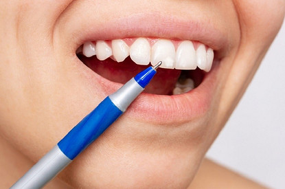 Белые пятна на зубах у ребенка и взрослого: главные причины и методы избавления