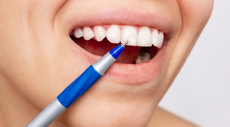 Белые пятна на зубах у ребенка и взрослого: главные причины и методы избавления