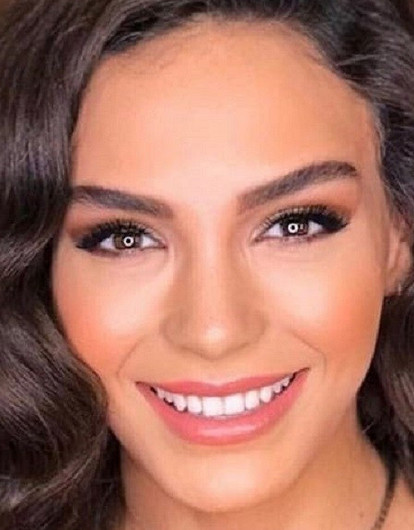 Эбру Шахин из сериала «Ветреный»: биография, личная жизнь, фото до и после пластики