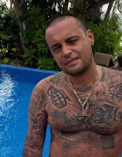 «Печальные новости»: Гуф отменил концерты из-за перелома ребра