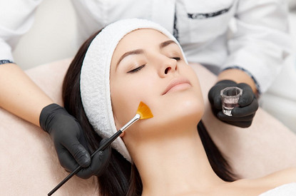 Молочный, миндальный или Джесснера: лучшие пилинги на эту зиму