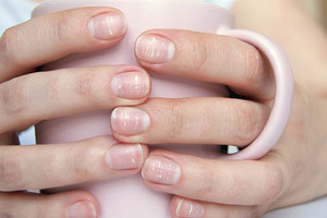 От неграмотного маникюра до отравления: откуда берутся белые пятна на ногтях рук