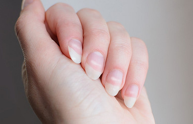 Почему появляются белые пятна на ногтях