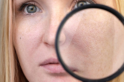 Как сузить расширенные поры: действенные советы