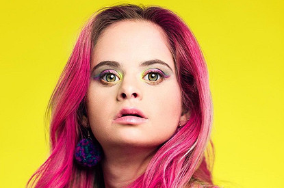 Модель с синдромом Дауна стала лицом Victoria’s Secret