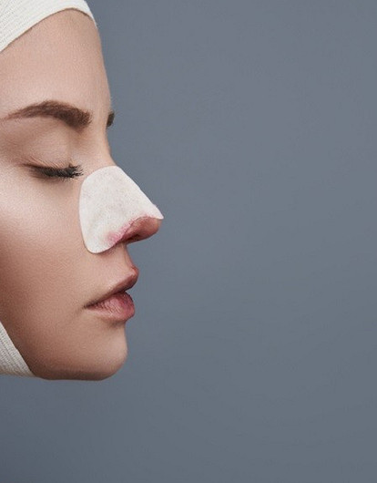 Не зарубить на носу: в каких случаях ринопластика может быть опасна