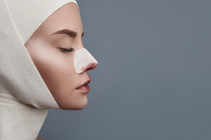 Не зарубить на носу: в каких случаях ринопластика может быть опасна