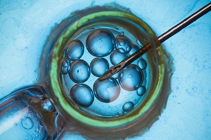 ЭКО: что это за процедура (все этапы и возможные риски)